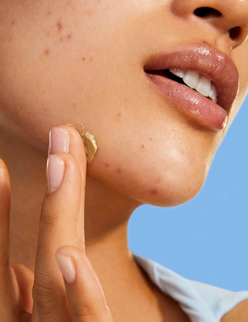BLEMISH CLEARING PASTE - Tratamiento Anti-imperfecciones